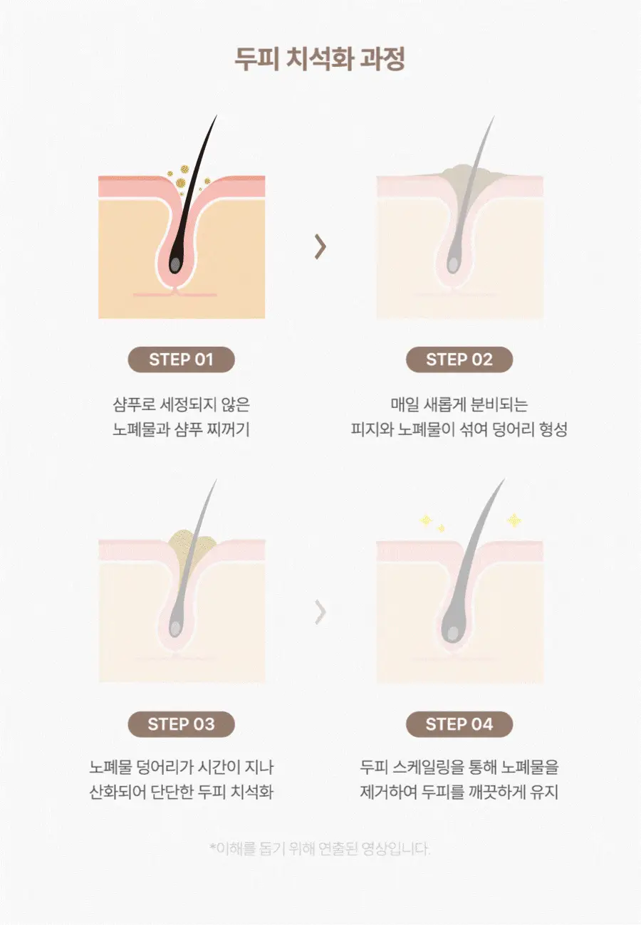 [각질/비듬/떡짐NO] 하아르 닥터초엔 탈모 헤어식초 300ml 상세페이지 12